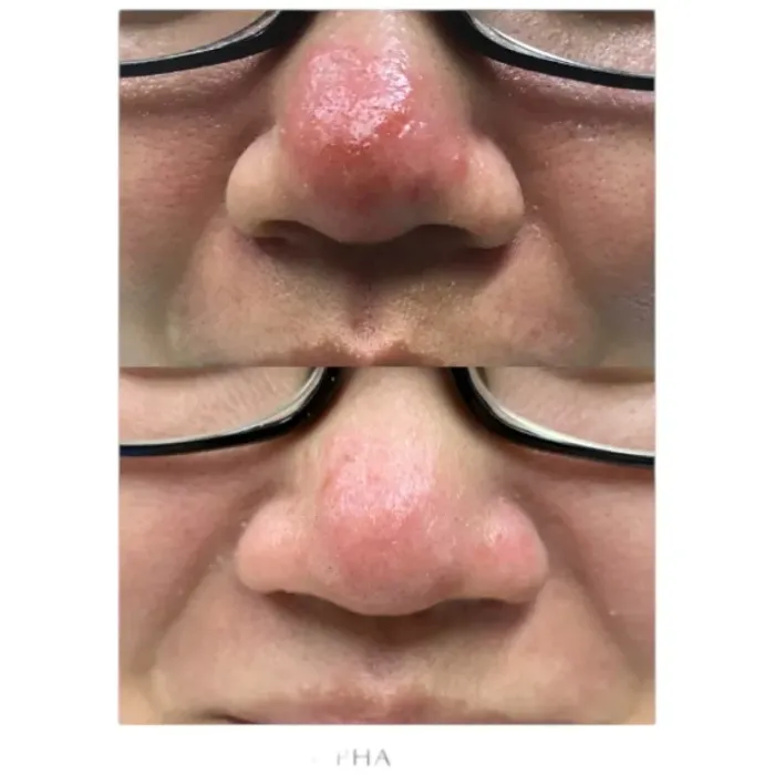 Сыворотка обновляющая с фитиновой кислотой Alphascience Phytic [TC] Serum